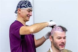 Haartransplantation Türkei Kosten: Affordable Solutions for Hair Loss