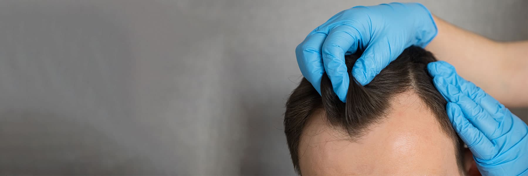 Im Detail: Wie viele Haare hat ein Mensch an verschiedenen Körperstellen?