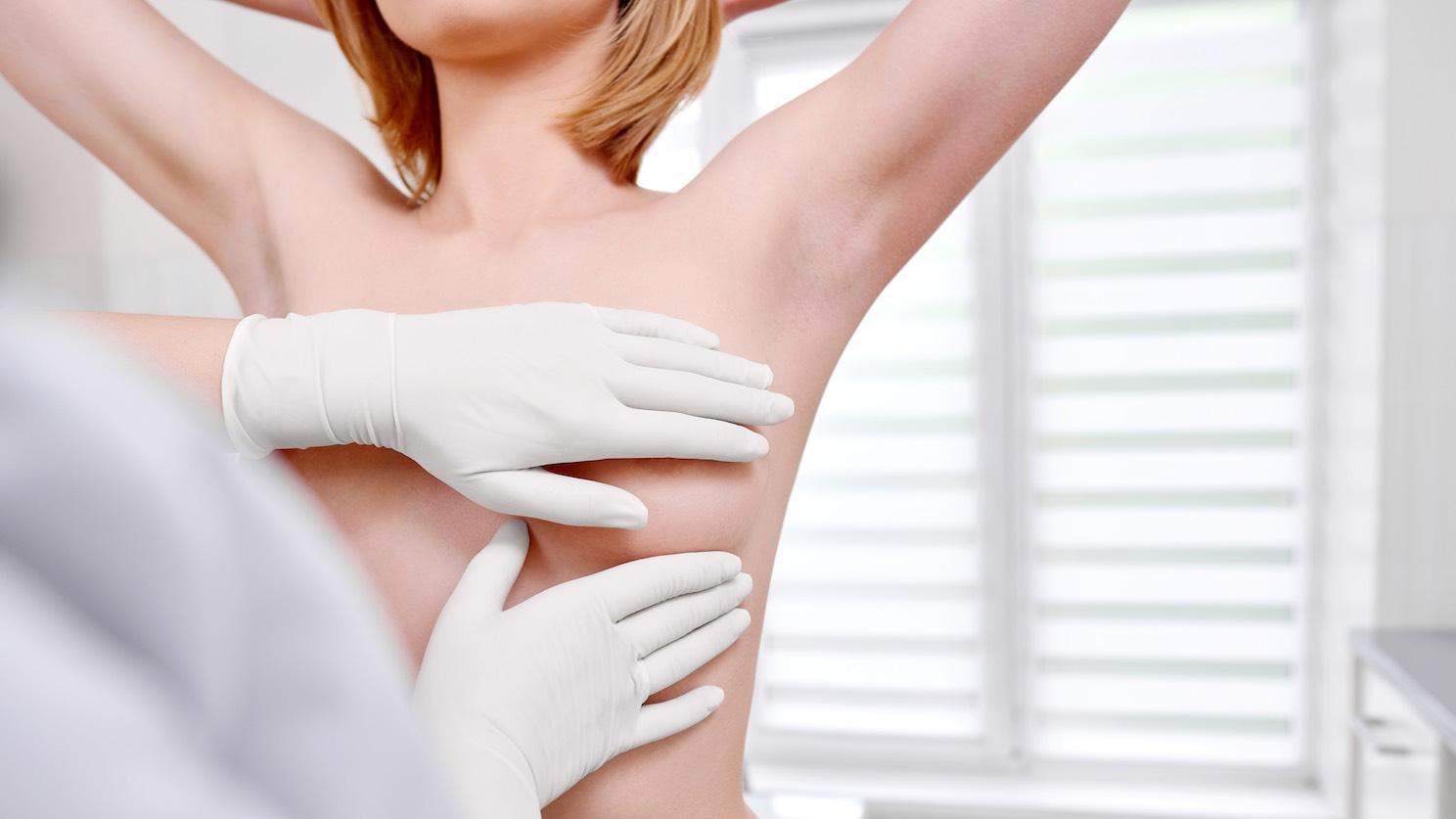 Wie die Bruststraffung mit Autoaugmentation die Jugendlichkeit der Brust ohne Silikonimplantate wiederherstellt